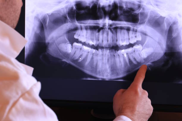 Best Emergency TMJ Treatment in Swannanoa, NC