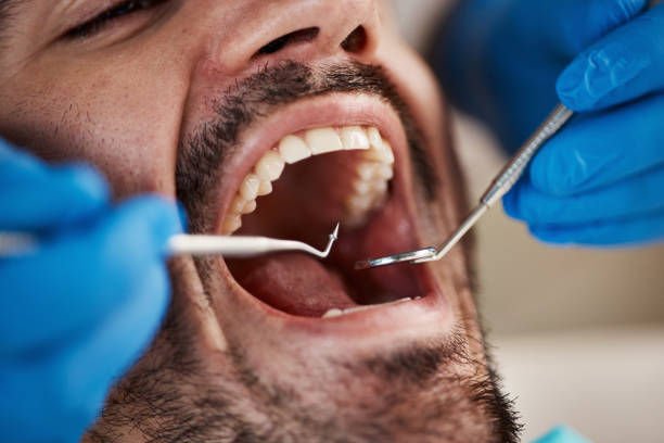 Best Same-Day Emergency Dental Services in Swannanoa, NC