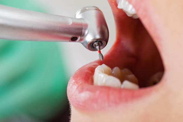 Best Emergency Treatment for Dental Infections or Abscesses in Swannanoa, NC